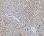 Aldo-keto Reductase Family 1 Member C1/DD1 Antibody in Immunohistochemistry (Paraffin) (IHC (P))