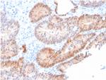 Aldo-keto Reductase Family 1 Member C2/DD2 Antibody in Immunohistochemistry (Paraffin) (IHC (P))