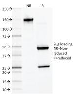 Desmin (Muscle Cell Marker) Antibody in SDS-PAGE (SDS-PAGE)