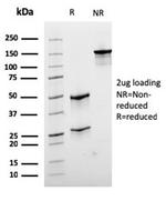 Desmin (Muscle Cell Marker) Antibody in Immunoelectrophoresis (IE)