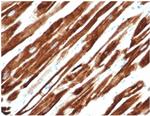 Desmin (Muscle Cell Marker) Antibody in Immunohistochemistry (Paraffin) (IHC (P))