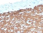 Desmin (Muscle Cell Marker) Antibody in Immunohistochemistry (Paraffin) (IHC (P))