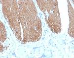 Desmin (Muscle Cell Marker) Antibody in Immunohistochemistry (Paraffin) (IHC (P))