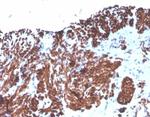 Desmin (Muscle Cell Marker) Antibody in Immunohistochemistry (Paraffin) (IHC (P))