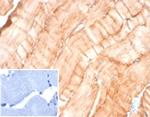 Desmin (Muscle Cell Marker) Antibody in Immunohistochemistry (Paraffin) (IHC (P))