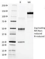 AFP (Alpha Fetoprotein) (Hepatocellular/Germ Cell Tumor Marker) Antibody in SDS-PAGE (SDS-PAGE)