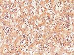 AFP (Alpha Fetoprotein) (Hepatocellular/Germ Cell Tumor Marker) Antibody in Immunohistochemistry (Paraffin) (IHC (P))