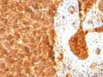 AFP (Alpha Fetoprotein) (Hepatocellular/Germ Cell Tumor Marker) Antibody in Immunohistochemistry (Paraffin) (IHC (P))