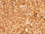 AFP (Alpha Fetoprotein) Antibody in Immunohistochemistry (Paraffin) (IHC (P))