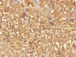 AFP (Alpha Fetoprotein) (Hepatocellular/Germ Cell Tumor Marker) Antibody in Immunohistochemistry (Paraffin) (IHC (P))