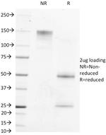 AFP (Alpha Fetoprotein) (Hepatocellular/Germ Cell Tumor Marker) Antibody in SDS-PAGE (SDS-PAGE)