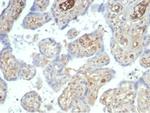 AFP (Alpha Fetoprotein) (Hepatocellular/Germ Cell Tumor Marker) Antibody in Immunohistochemistry (Paraffin) (IHC (P))