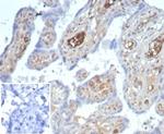 AFP (Alpha Fetoprotein) (Hepatocellular/Germ Cell Tumor Marker) Antibody in Immunohistochemistry (Paraffin) (IHC (P))