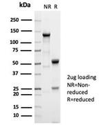 AFP (Alpha Fetoprotein) (Hepatocellular/Germ Cell Tumor Marker) Antibody in Immunoelectrophoresis (IE)