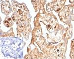 AFP (Alpha Fetoprotein) (Hepatocellular/Germ Cell Tumor Marker) Antibody in Immunohistochemistry (Paraffin) (IHC (P))