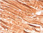 Dystrophin (DMD) Antibody in Immunohistochemistry (Paraffin) (IHC (P))