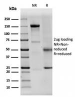 Dystrophin (DMD) Antibody in SDS-PAGE (SDS-PAGE)