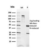 Dystrophin (DMD) (Marker of Duchenne and Becker Muscular Dystrophy) Antibody in Immunoelectrophoresis (IE)