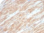 Dystrophin (DMD) (Marker of Duchenne and Becker Muscular Dystrophy) Antibody in Immunohistochemistry (Paraffin) (IHC (P))