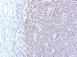 DNMT1/DNA Methyltransferase 1 Antibody in Immunohistochemistry (Paraffin) (IHC (P))