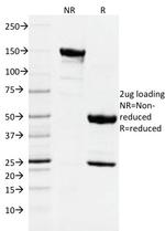 DNMT1/DNA Methyltransferase 1 Antibody in SDS-PAGE (SDS-PAGE)