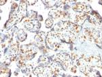 DNMT3A/DNA Methyltransferase 3 Alpha Antibody in Immunohistochemistry (Paraffin) (IHC (P))