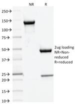 DNMT3A/DNA Methyltransferase 3 Alpha Antibody in SDS-PAGE (SDS-PAGE)