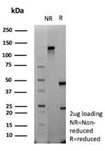 TdT/DNA Nucleotidylexotransferase Antibody in SDS-PAGE (SDS-PAGE)