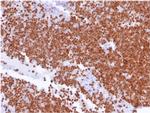 TdT/DNA Nucleotidylexotransferase Antibody in Immunohistochemistry (Paraffin) (IHC (P))