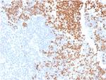 TdT/DNA Nucleotidylexotransferase (Acute Lymphoblastic Leukemia Marker) Antibody in Immunohistochemistry (Paraffin) (IHC (P))