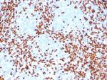 TdT/DNA Nucleotidylexotransferase (Acute Lymphoblastic Leukemia Marker) Antibody in Immunohistochemistry (Paraffin) (IHC (P))