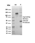 TdT/DNA Nucleotidylexotransferase (Acute Lymphoblastic Leukemia Marker) Antibody in SDS-PAGE (SDS-PAGE)