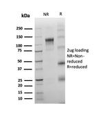 TdT/DNA Nucleotidylexotransferase (Acute Lymphoblastic Leukemia Marker) Antibody in Immunoelectrophoresis (IE)