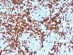 TdT/DNA Nucleotidylexotransferase Antibody in Immunohistochemistry (Paraffin) (IHC (P))