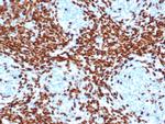 TdT/DNA Nucleotidylexotransferase Antibody in Immunohistochemistry (Paraffin) (IHC (P))