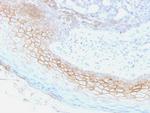 Desmocollin-2/3 Antibody in Immunohistochemistry (Paraffin) (IHC (P))