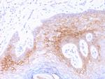 Desmocollin-2/3 Antibody in Immunohistochemistry (Paraffin) (IHC (P))