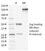 Desmocollin-2/3 Antibody in SDS-PAGE (SDS-PAGE)