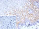 Desmocollin-2/3 Antibody in Immunohistochemistry (Paraffin) (IHC (P))