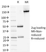 Desmoglein-1 (DSG1) Antibody in SDS-PAGE (SDS-PAGE)