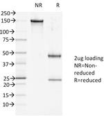 Desmoglein-1 (DSG1) Antibody in SDS-PAGE (SDS-PAGE)