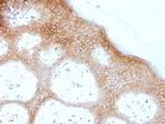 Desmoglein-1 (DSG1) Antibody in Immunohistochemistry (Paraffin) (IHC (P))