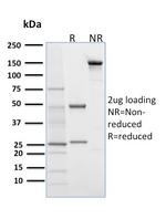 Desmoglein-1 (DSG1) Antibody in SDS-PAGE (SDS-PAGE)