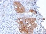 Desmoglein-1 (DSG1) Antibody in Immunohistochemistry (Paraffin) (IHC (P))