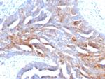 TAG-72/CA72.4 (Tumor-Associated Glycoprotein) Antibody in Immunohistochemistry (Paraffin) (IHC (P))