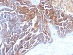 TAG-72/CA72.4 (Tumor-Associated Glycoprotein) Antibody in Immunohistochemistry (Paraffin) (IHC (P))