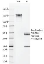 TAG-72/CA72.4 (Tumor-Associated Glycoprotein) Antibody in SDS-PAGE (SDS-PAGE)