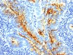 TAG-72/CA72.4 (Tumor-Associated Glycoprotein) Antibody in Immunohistochemistry (Paraffin) (IHC (P))