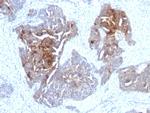 TAG-72/CA72.4 (Tumor-Associated Glycoprotein) Antibody in Immunohistochemistry (Paraffin) (IHC (P))