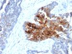 TAG-72/CA72.4 (Tumor-Associated Glycoprotein) Antibody in Immunohistochemistry (Paraffin) (IHC (P))